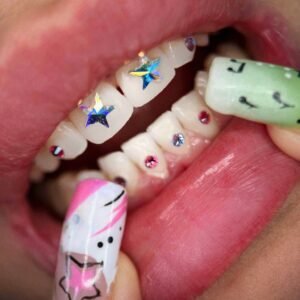 corso online applicazione gemme dentali
