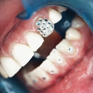 corso online applicazione gemme dentali