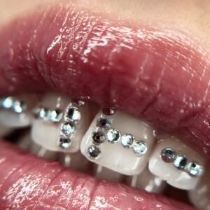 Corso Gemme Dentali BiGemz