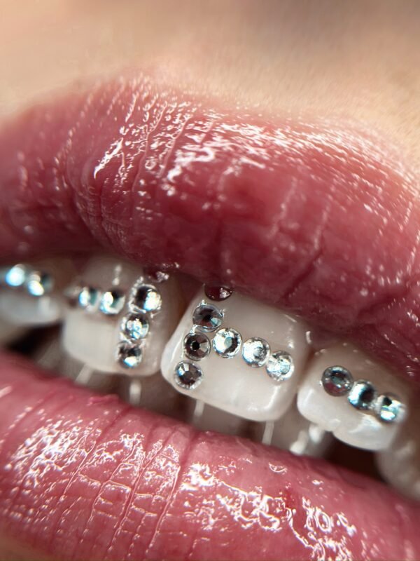 Essential 100% Online [Senza Kit]