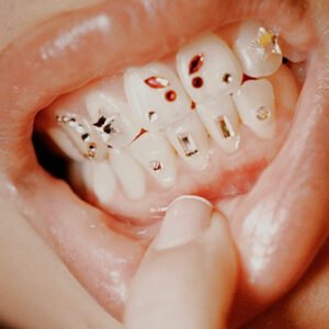 corso gemme dentali torino