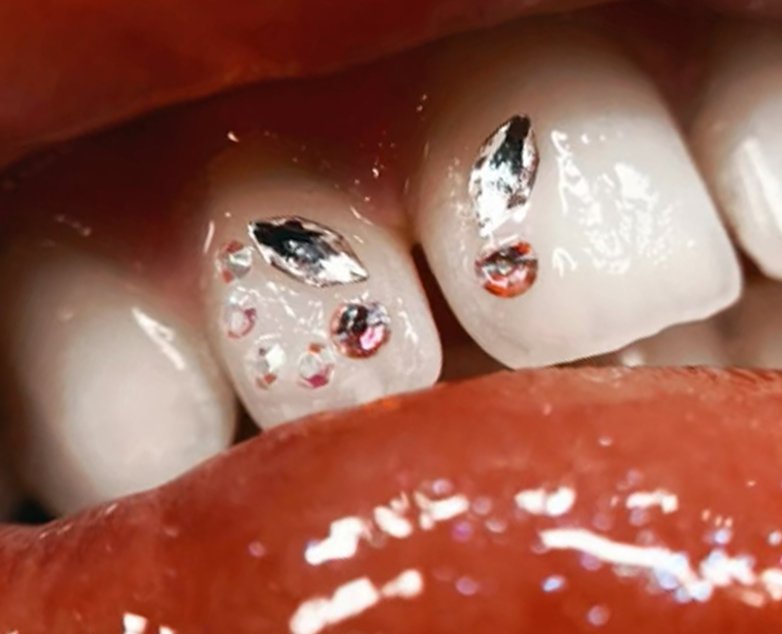 corso professionale gemme dentali