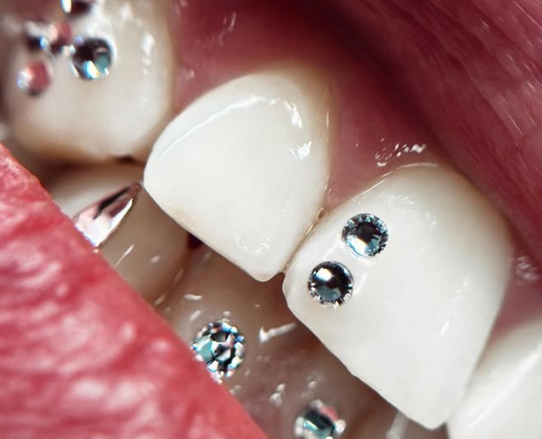 opinioni corso gemme dentali online bigemz