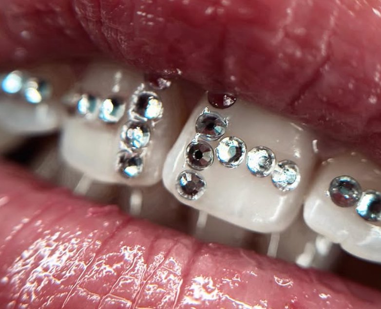 corso tooth gems migliore online