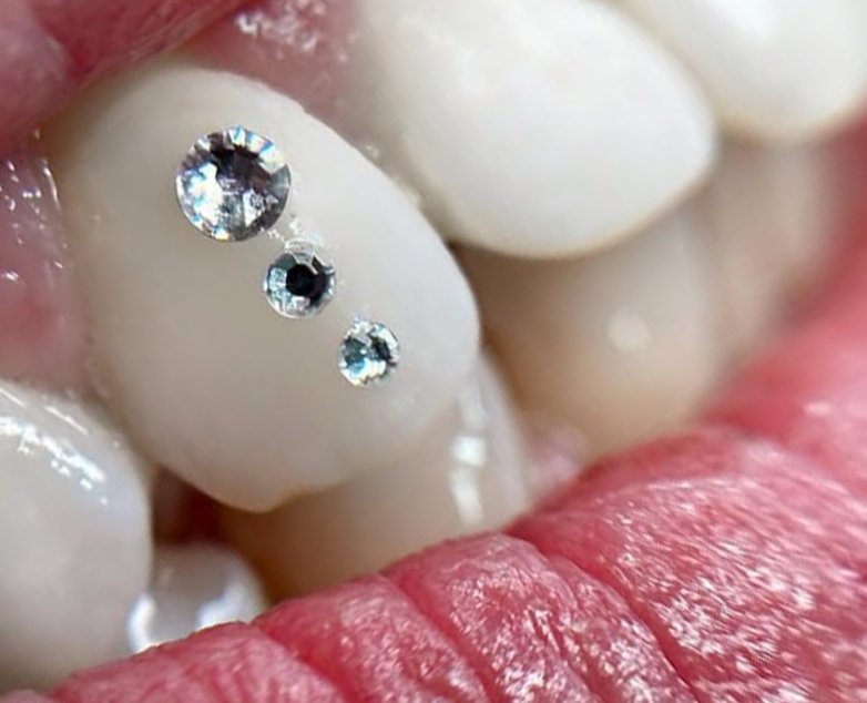 miglior corso gemme dentali