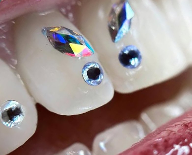 corso applicazione gemme denti