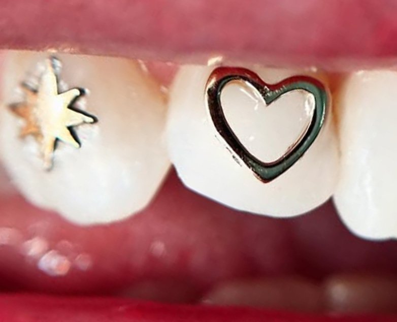 corso gemme denti online